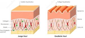 glatte vs faltige haut